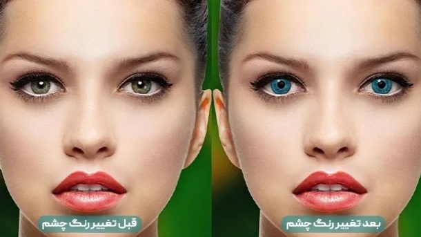 هزینه 300 میلیون تومانی عمل تغییر رنگ چشم