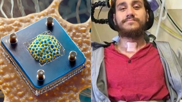 تجربه زندگی با تراشه مغزی ایلان ماسک