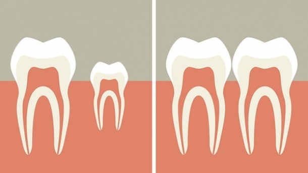 آغاز آزمایش داروی رشد دوبارۀ دندان