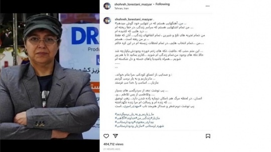 شهره لرستانی تغییر جنسیت داد، نام جدید او چیست؟ / عکس