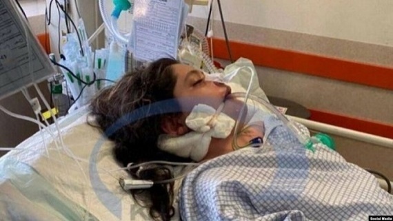 بررسی بیانیه پزشکی قانونی در خصوص علت مرگ مهسا امینی