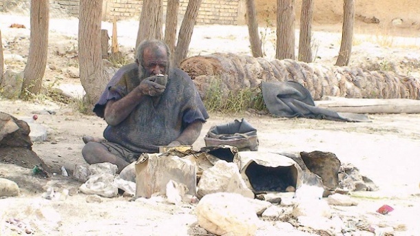 عجایب 60 سال حمام نرفتن یک مرد ایرانی + تصویر