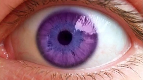 عجیب‌ترین رنگ چشم دنیا؛ بنفش!