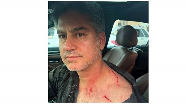 بلایی که سارقان بر سر مربی تیم ملی آوردند + عکس