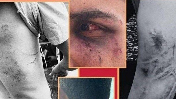 ماجرای حمله به گردشگران در اوپرت با سلاح گرم و شوکر